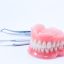 Complete-Denture
