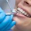 Dental-Checkup