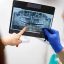 Dental-X-ray-1