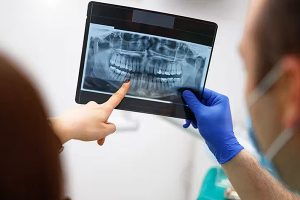 Dental-X-ray