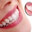 Full-Mouth-Rehabilitation