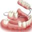 Removable-Partial-Denture-1